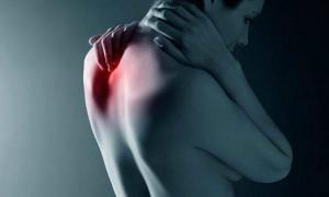 Невралгия плечевого нерва: симптомы, лечение